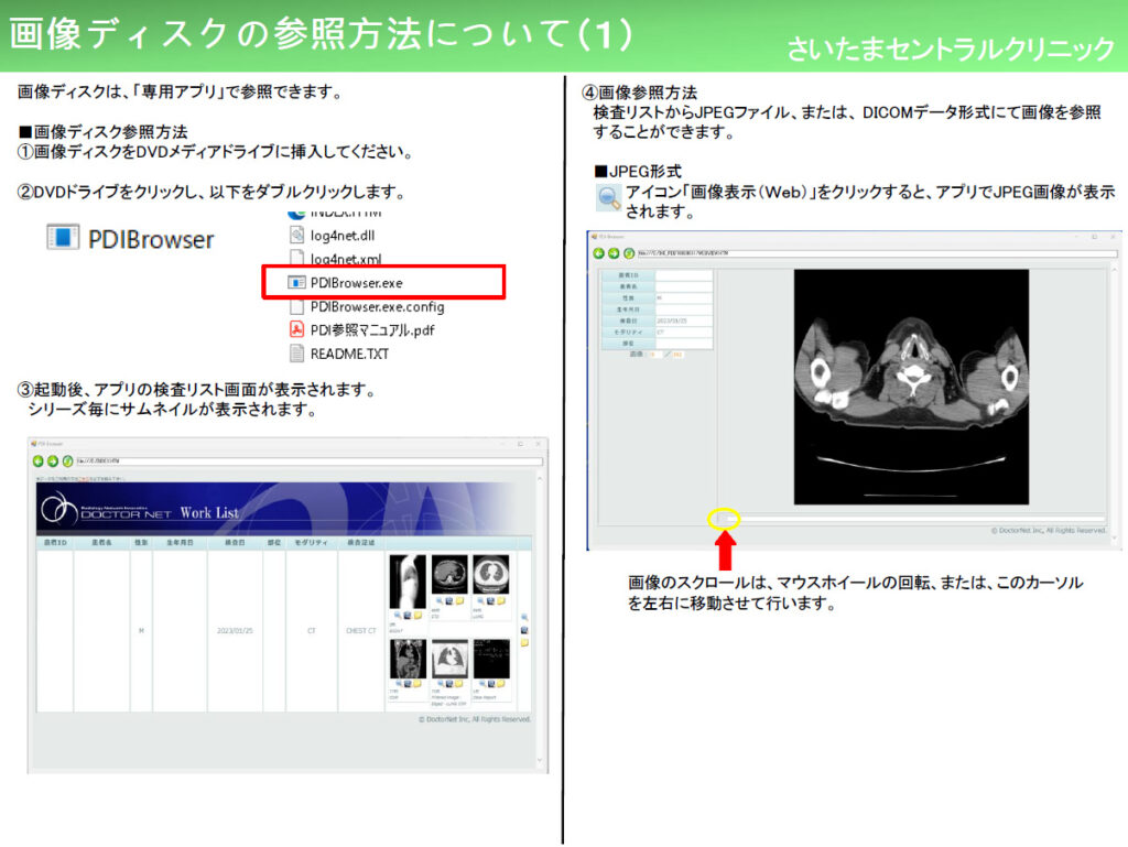 画像ディスクの参照方法について